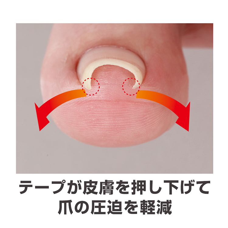 透明巻き爪テープ　ミエーヌ