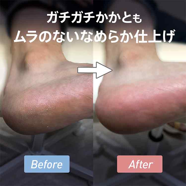 お取り寄せ my&bee m.Soin コードレスフットグラインダー