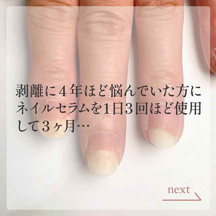 お取り寄せ my&bee m.Soin ダメージネイルセラム