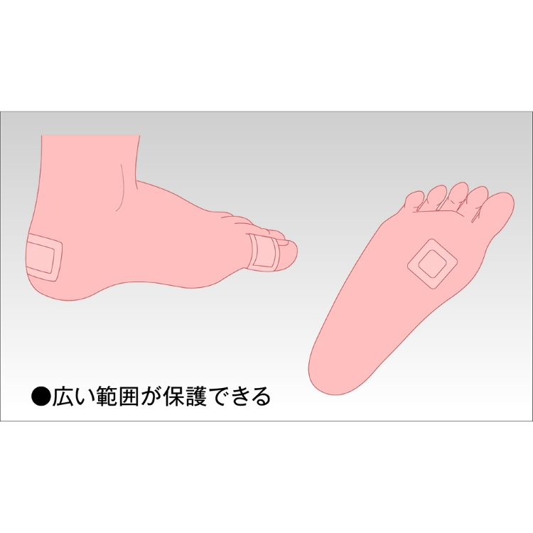 お取り寄せ ソルボバン スクウェアタイプ